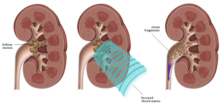 difference between liver and kidney